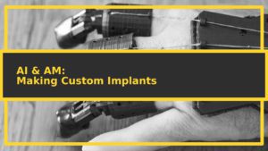 featuredimage customimplants