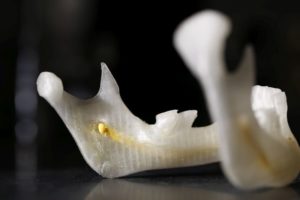 D prototyping broken and deformed bone anatomical models to educate doctors htm afeafa