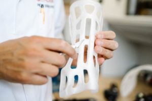 3D printed cast